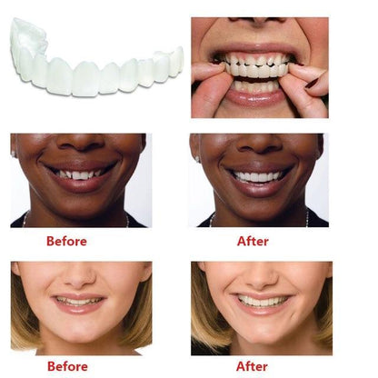 Snap on Veneers Upper and Lower 2 Pcs